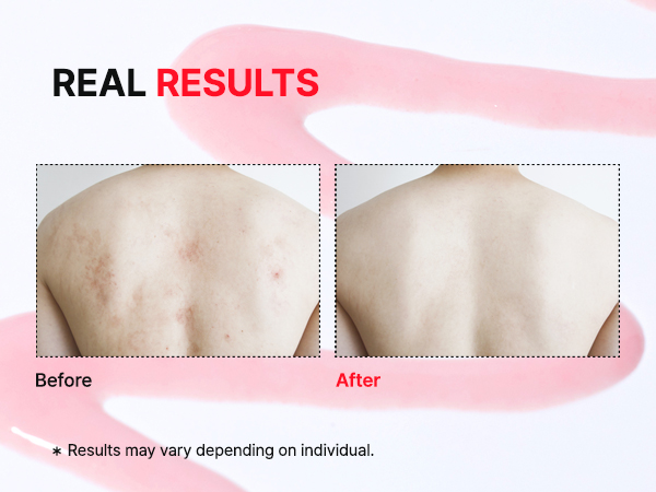 (모바일)안티블래미쉬-3_1