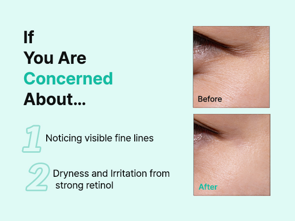 TIAM Vita A Bakuchiol Firming Eye Cream6 تاثیر و نحوه استفاده از TIAM Vita A Bakuchiol Firming Eye Cream